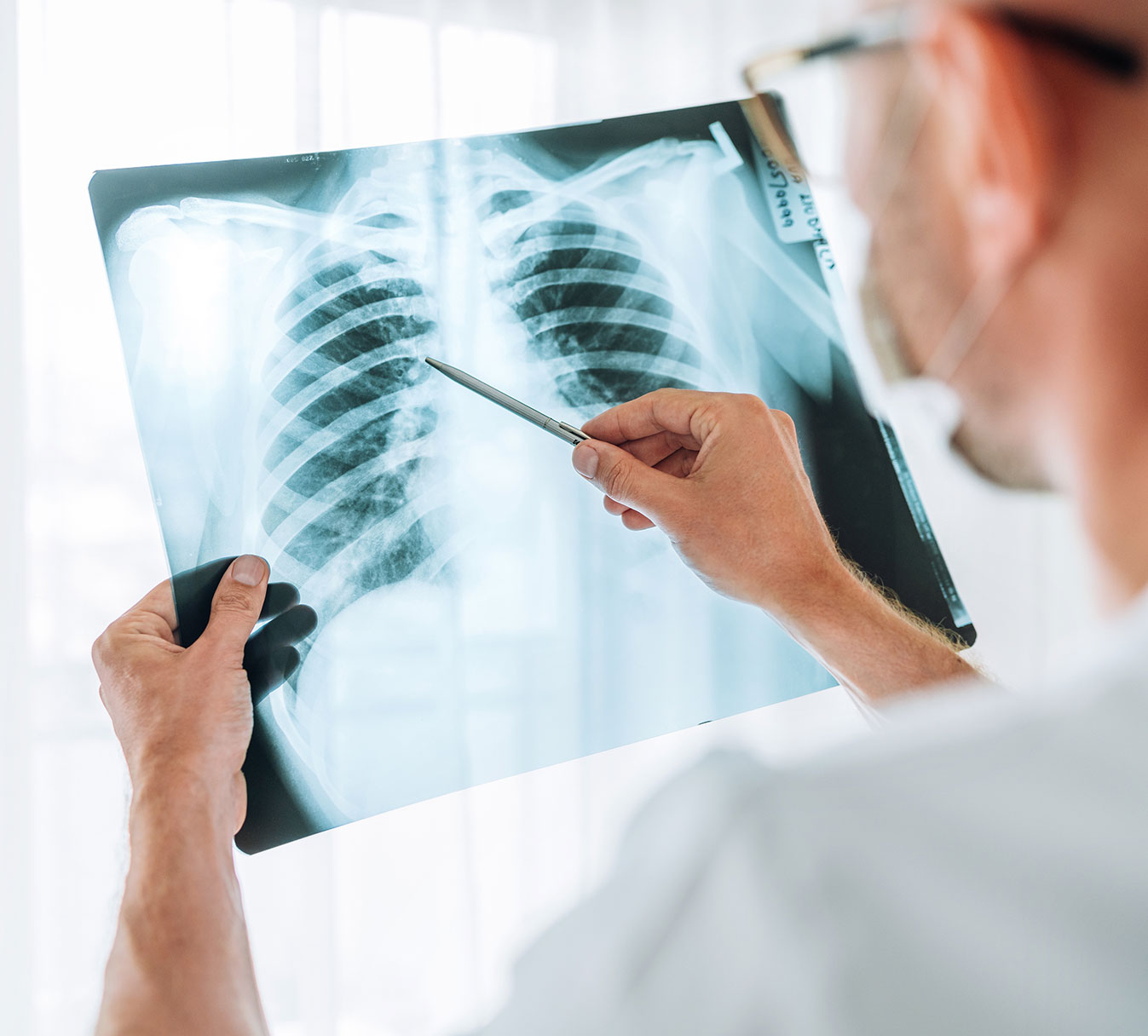 Mesothelioma Lawyers in New York City